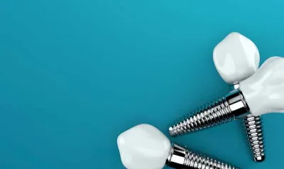 The Science Behind Dental Implants: How They Work and Their Benefits