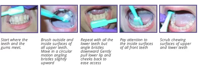 dental treatment in pune